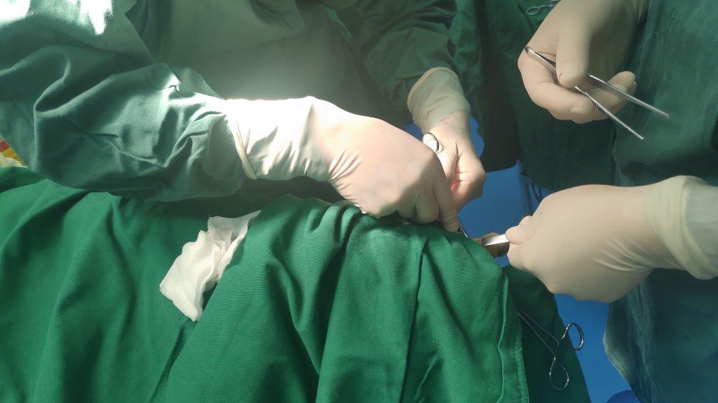 大脚骨轻微拇外翻怎么治疗好得快,大脚骨拇外翻最好的保守治疗方法