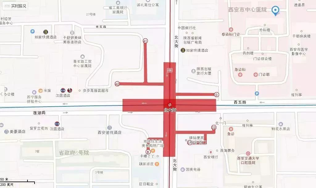 食道心电图正常可以排除什么疾病,食管内心电图和心脏调搏区别
