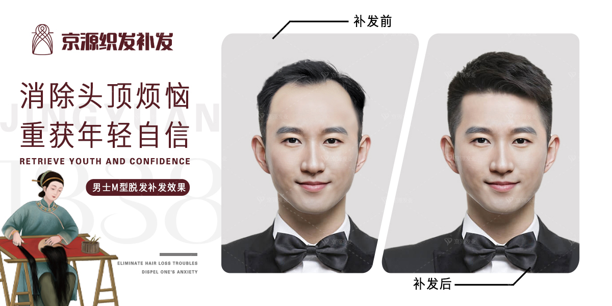 男式短发假发哪里好,长沙男士假发推荐排行榜