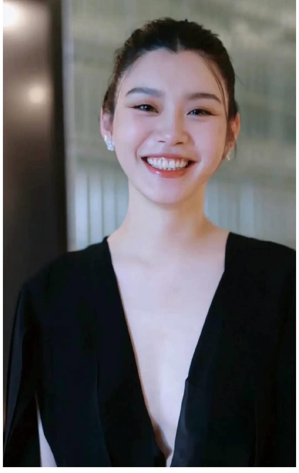 江苏苏王整形怎么样,苏王医疗整形做提眉怎么样