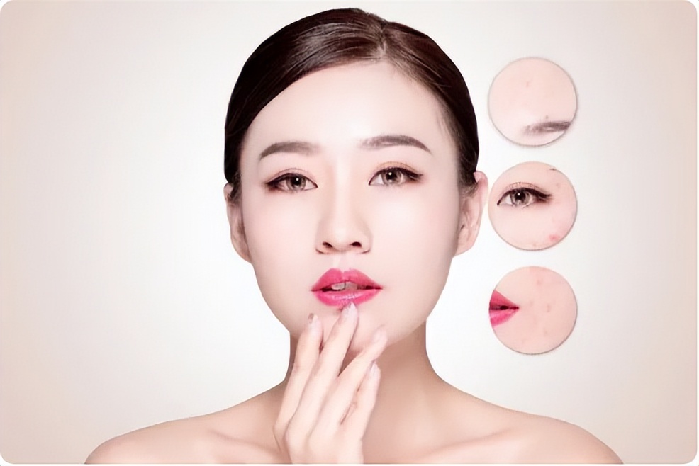 油脂粒粉刺怎么去除,萃雪肤祛痘产品副作用是啥