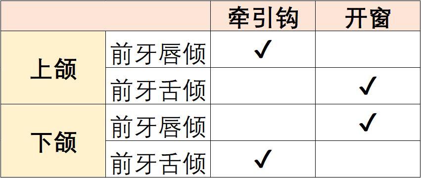 正畸隐形矫正皮筋怎么挂,正畸隐形牙套牵引作用