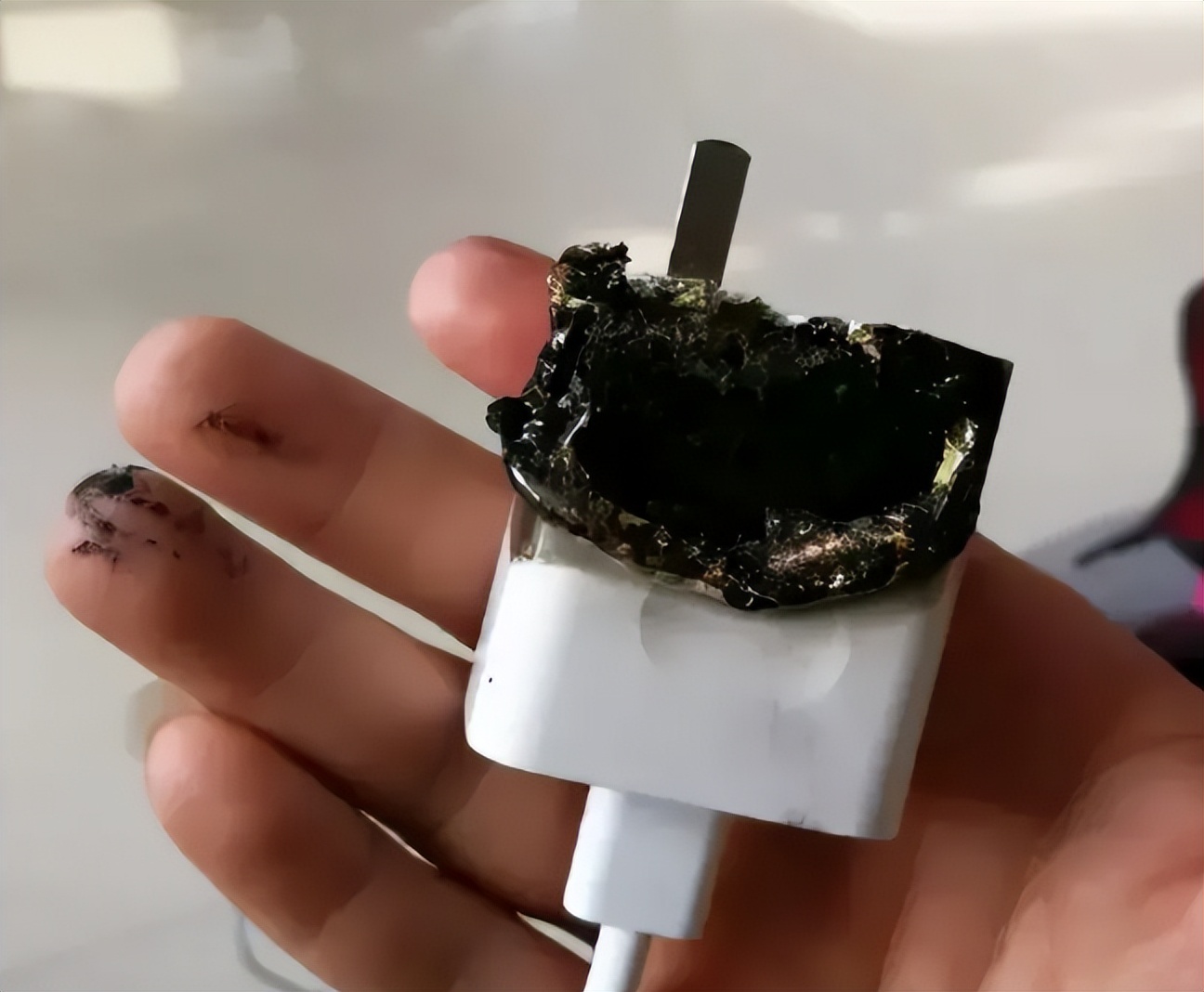 苹果充电被电到人要截肢,买iphone遭电击