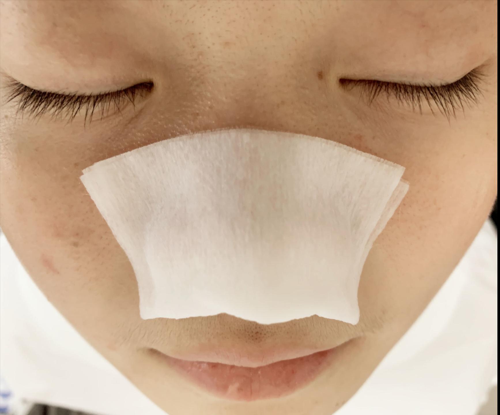 鼻子上好多黑头把毛孔堵住了,鼻子上的黑头怎么去除最有效方法