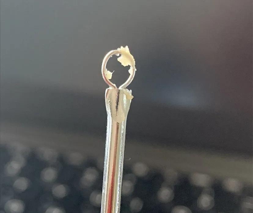 鼻子黑头感觉脏脏的,草莓黑头怎么去除最有效