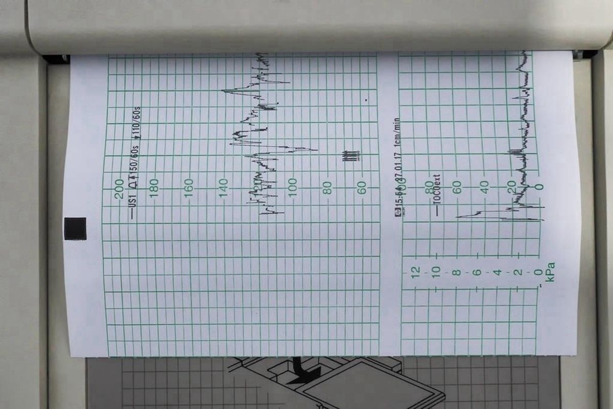 胎心率能辨别胎儿性格吗,看胎心率辨别胎儿有科学依据吗