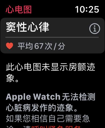 applewatch6功能最全介绍,applewatch6功能使用大全