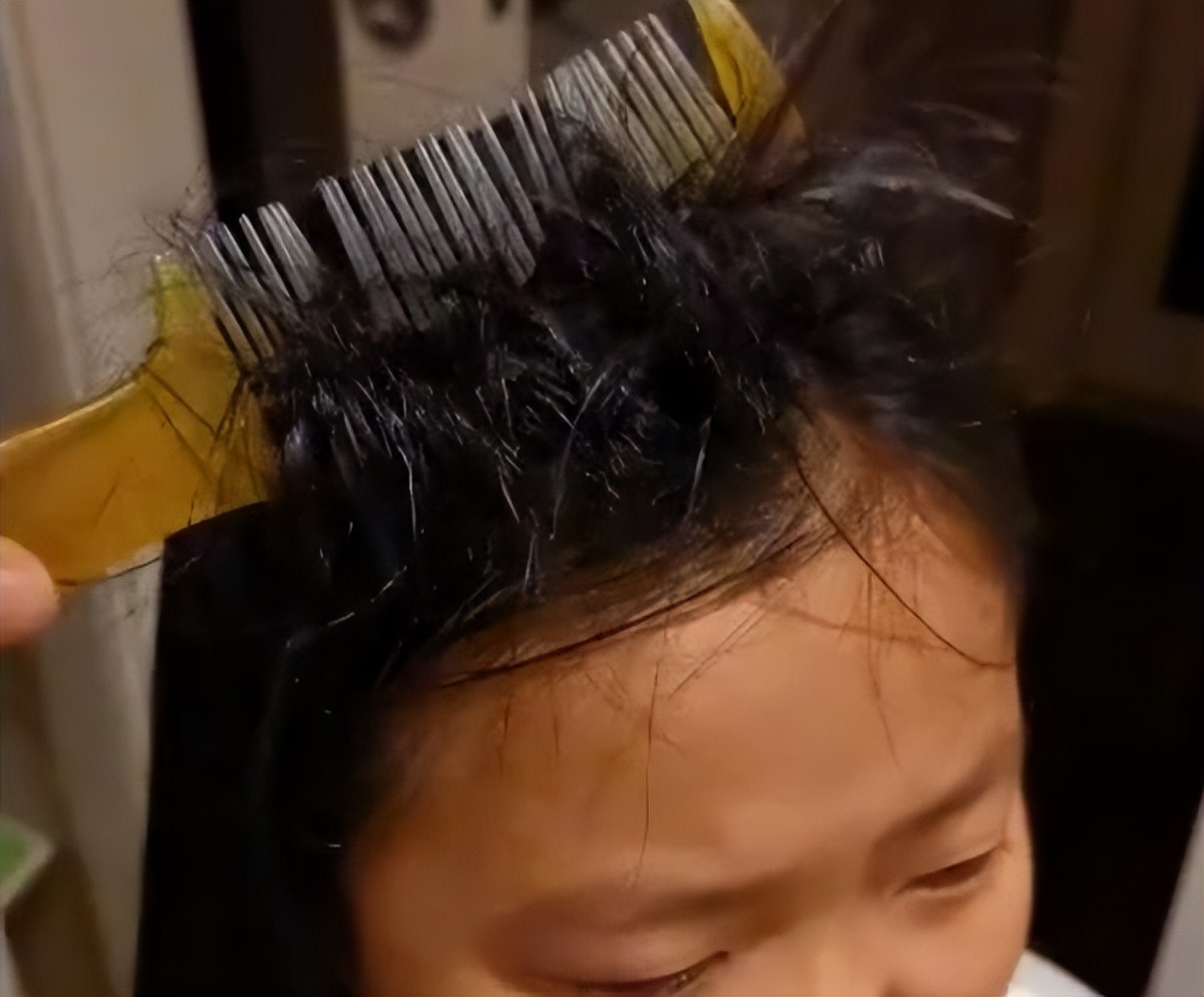 北京女孩头发被梳子卡住,女孩子头被梳子卡住