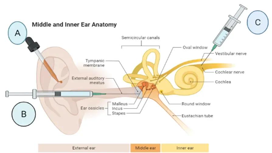 突发性耳聋激素治疗原则,突发性耳聋激素治疗多久有效果