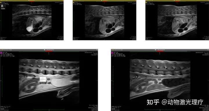 治疗案例分享100例,激光治疗癌症成功案例