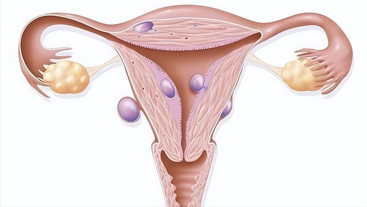 白带异常需提防哪几种炎症感染,白带是属于妇科病吗