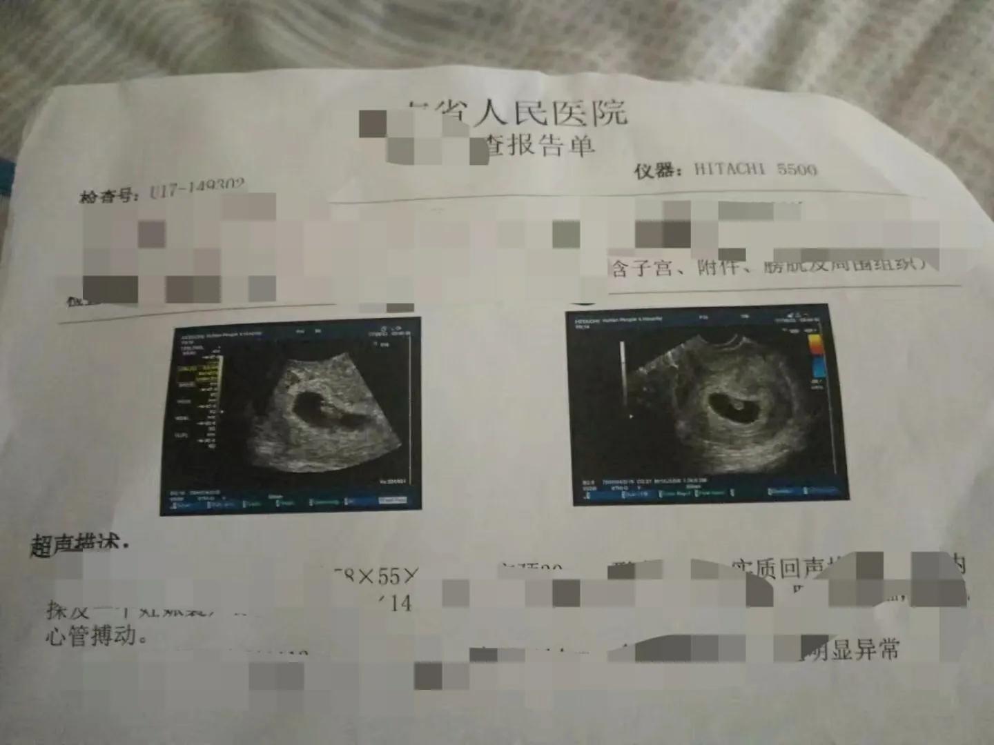 备孕三年成功，真的很想把我的这个路程分享给有需要的人