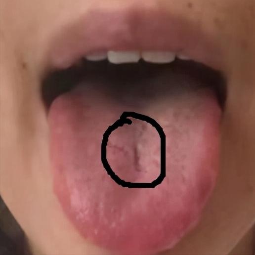 中医四诊中的正常舌象,中医看舌象准还是摸脉准