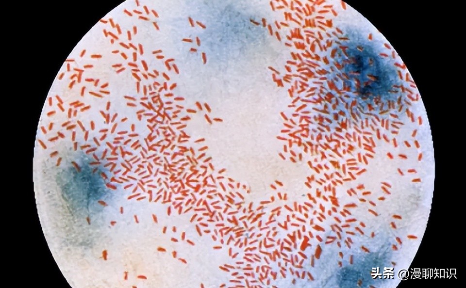 副猪嗜血杆菌是一种巴氏杆菌，其生长依赖于V因子，还有其他的吗