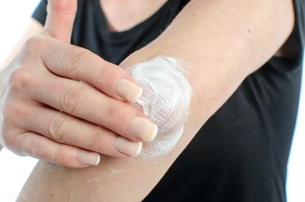 秋季皮肤痒起丘疹,皮肤瘙痒起小红疙瘩警惕4种疾病