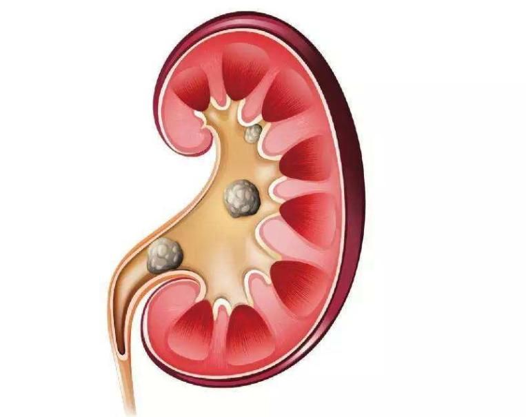 速效救心丸长期吃能治好冠心病吗,速效救心丸还可治十种病