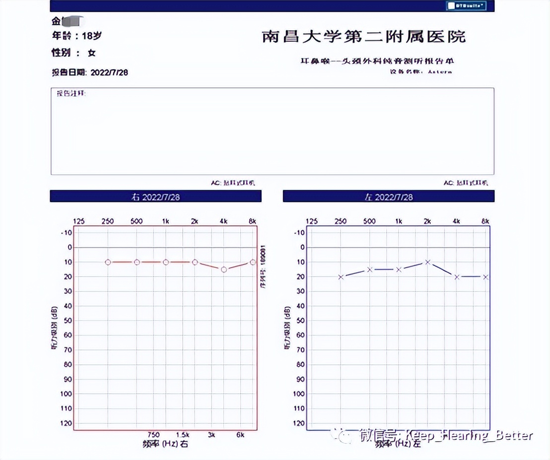 南昌大学第一附属医院鼓膜修复,南昌大学二附院耳鼻喉科专家介绍