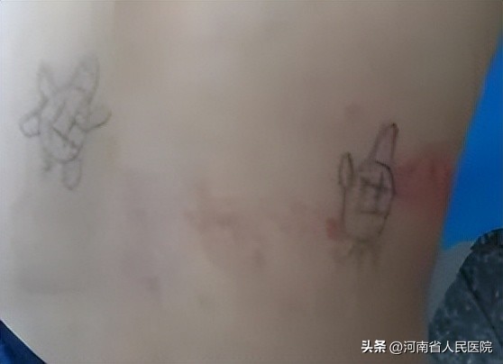 医生画鬼画符,医生鬼画符视频