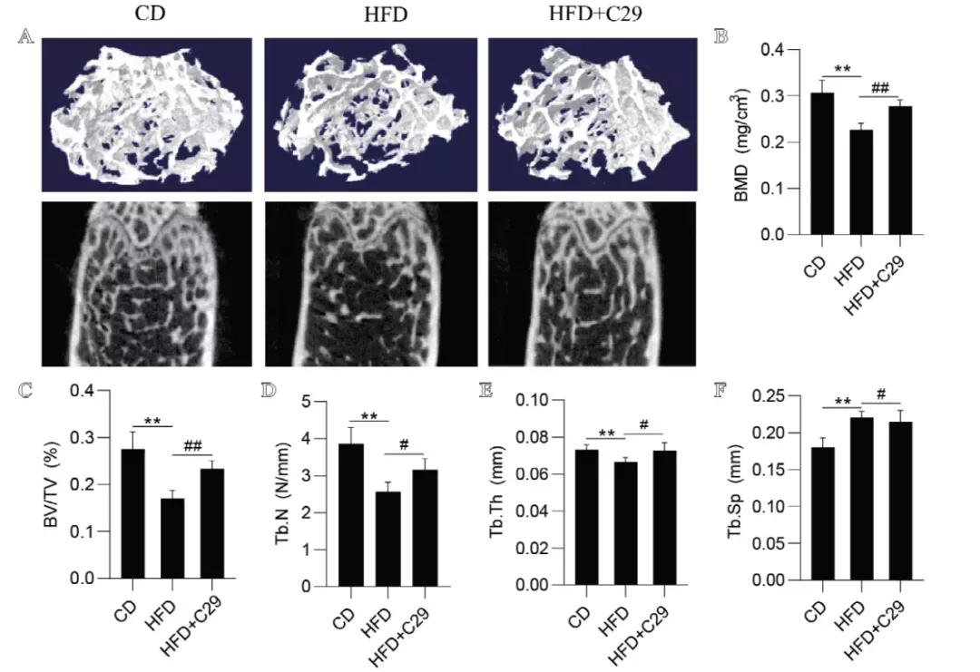 ERRα拮抗剂Compound29抑制破骨细胞改善肥胖引起的骨丢失