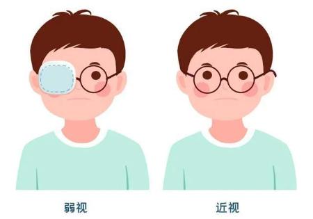 儿童弱视遮盖不愿意穿珠子,双眼弱视穿珠子训练需要遮盖吗