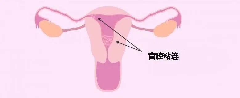 子宫内膜和卵泡必须达到什么标准才好受孕？