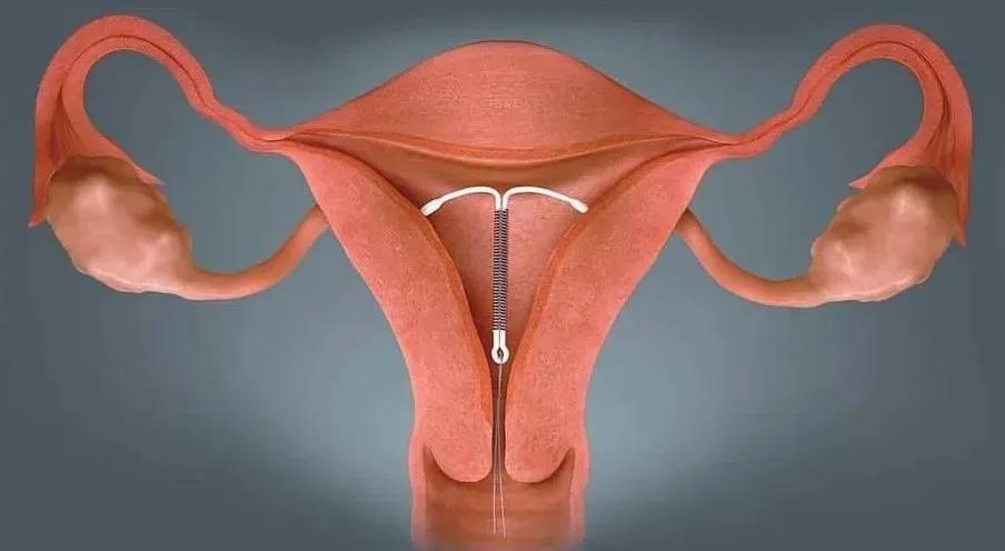 安全套真的防病吗,安全套真的安全吗