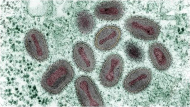 11个国家发现80多例猴痘，中国是否需要补种天花疫苗？