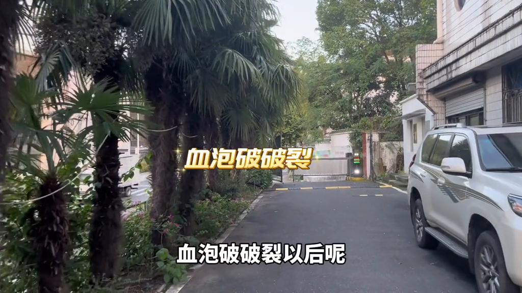 短尾蝮蛇咬伤致死率高吗,短尾蝮蛇咬伤后症状