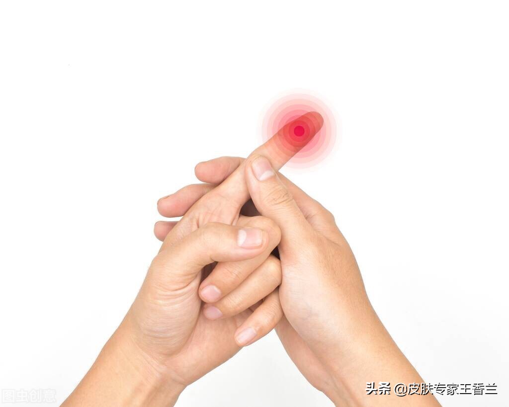 指甲长进肉一碰就疼,指甲长进肉里特别深