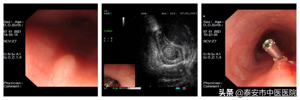 消化内镜微创诊治,消化内镜及消化疾病诊治
