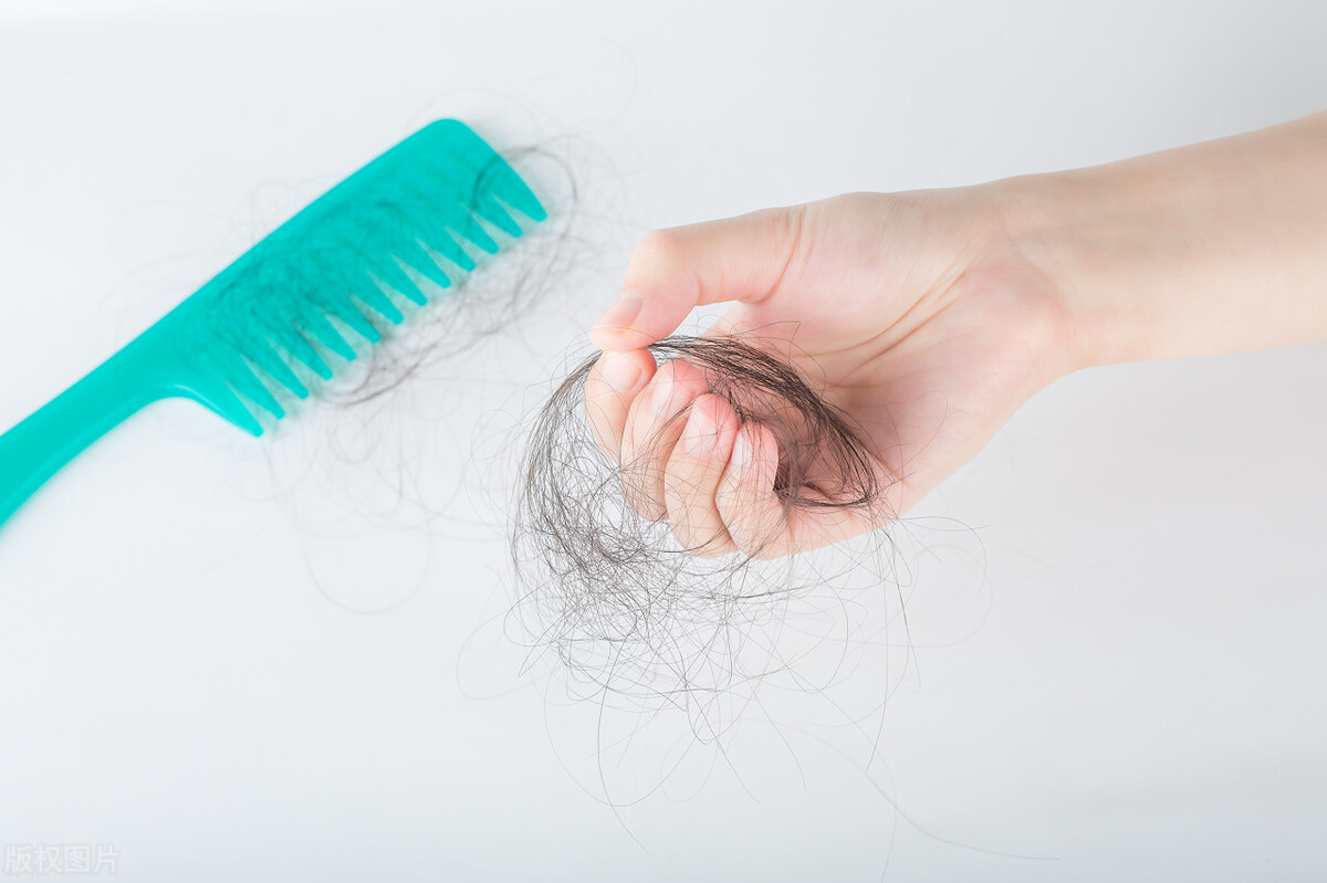 女性掉发脱发的原因及治疗,脱发头屑多的原因和治疗方法