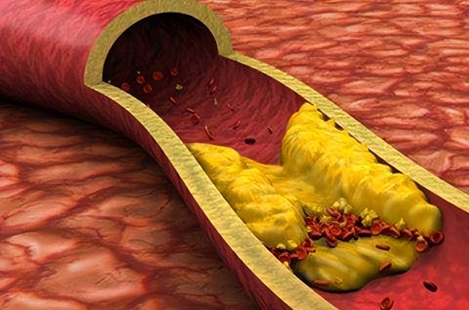 吃哪种食材才是补钙的最佳途径,怎么吃才补钙这3种方法简单有效
