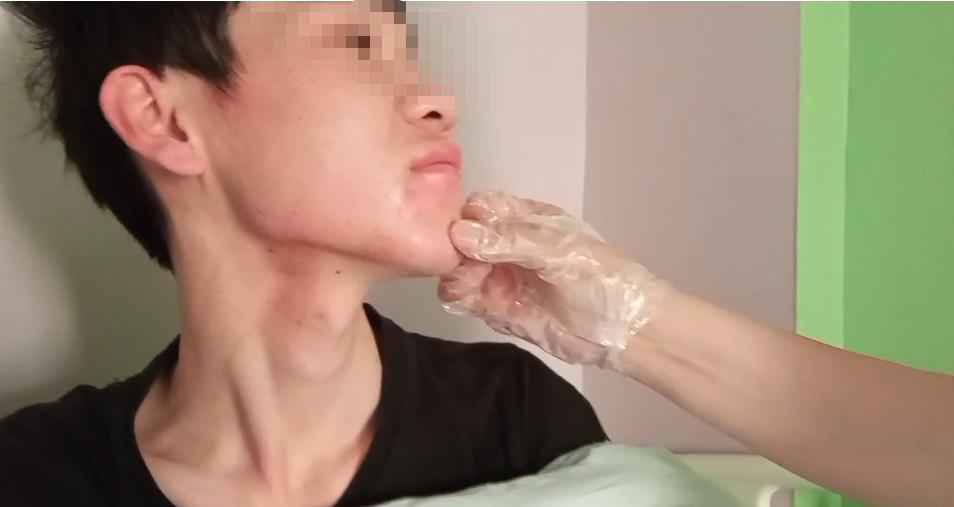 白癜风有不发展和自行恢复的吗,怎么可以控制白癜风发展