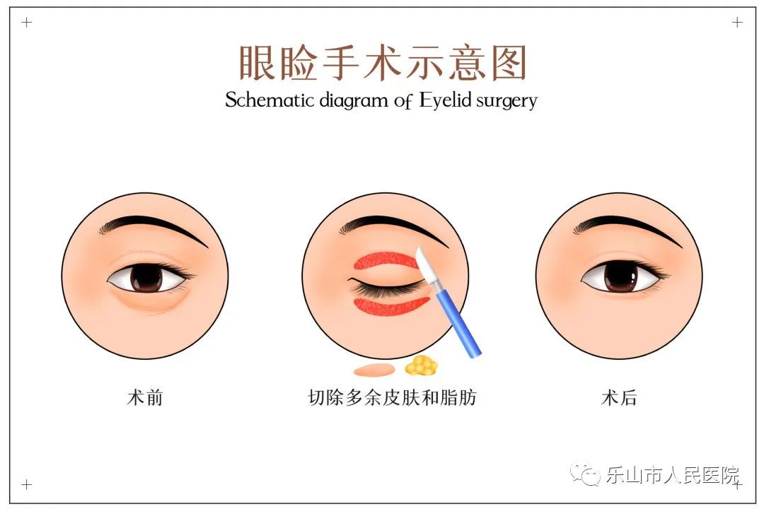 冬天适合做哪些医美项目,秋冬季适合做的医美项目