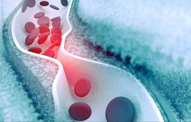 化疗引起周围神经病变,化疗导致周围神经病变