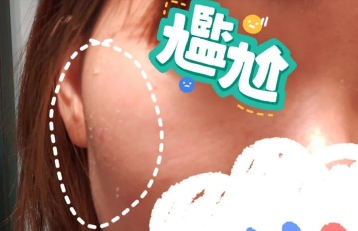 孕期水乳推荐孕妇敏感肌,孕期护肤水乳红黑榜