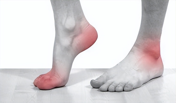 二妙丸清热祛湿,祛湿热二妙丸与什么搭配用