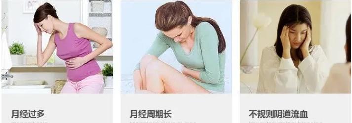 女人上环详细步骤,女性上环流程