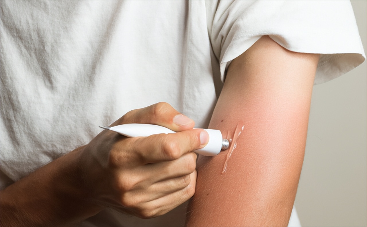 红霉素软膏都能治什么,红霉素和金霉素软膏的作用和功效