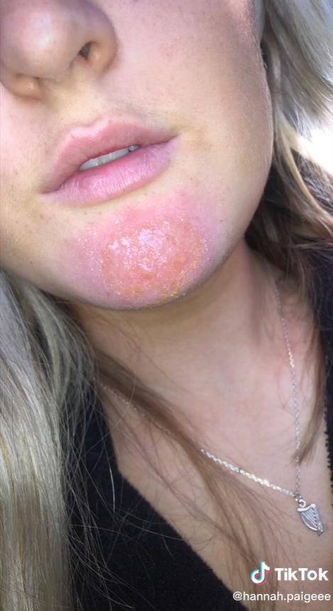 澳洲妹子和男友接吻,澳大利亚女子与男友接吻