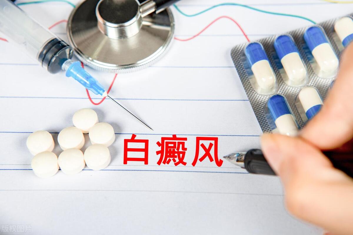 得了白癜风对寿命有影响吗,得了白癜风会对生活有什么影响