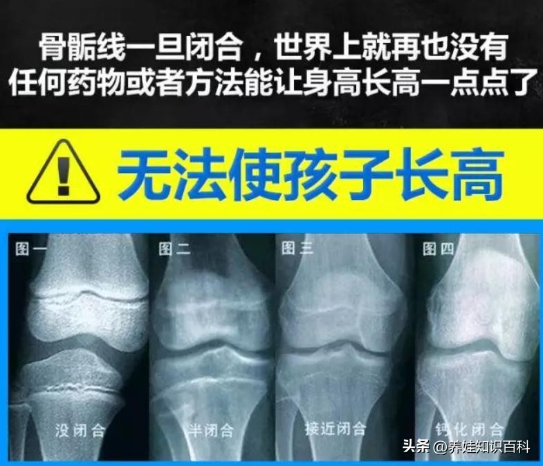 女孩13岁身高会猛长的征兆,女孩16岁身高会猛长的征兆