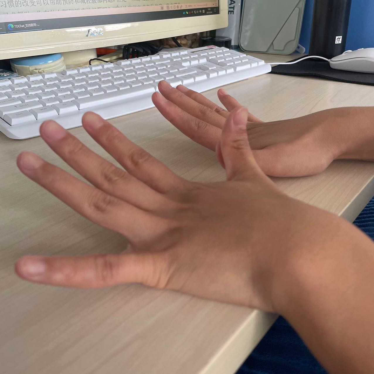 腰疼颈椎疼膝盖疼脚跟痛,颈椎药吃多了膝盖刺痛怎么办