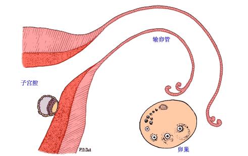 促排期间卵巢过度刺激综合征,促排期间卵巢过度刺激怎么办
