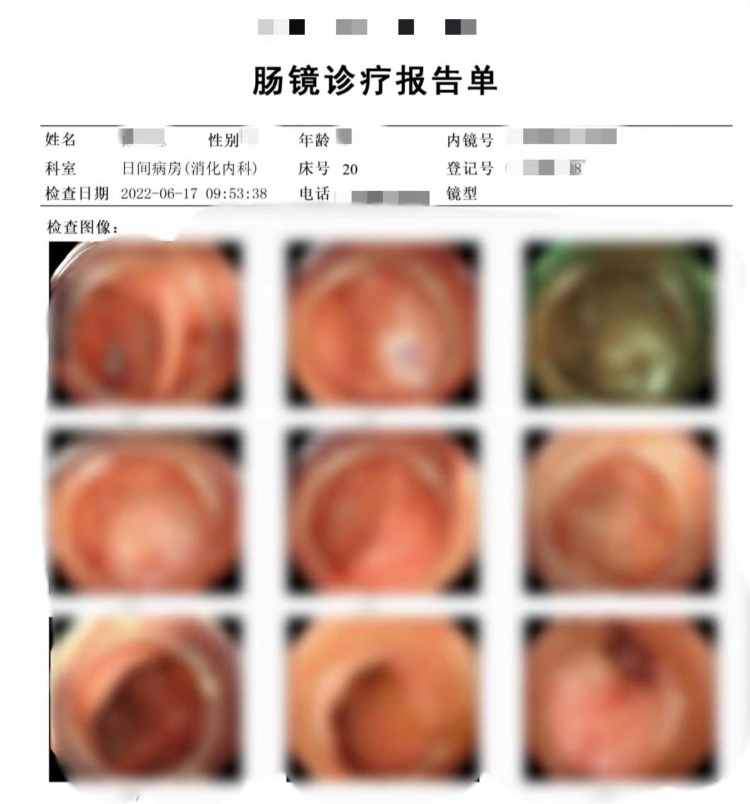 万万没想到，无意中做的胃肠镜，帮我捡回一条命