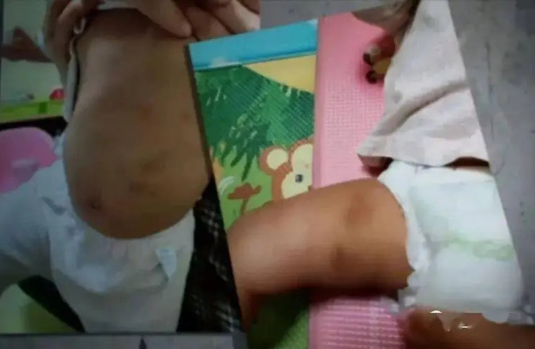 韩国女童被虐待致死,韩国女孩被虐待案结局