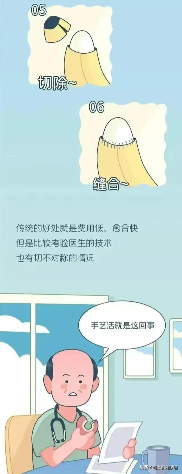 正经科普男人割“包皮”的那点事儿！