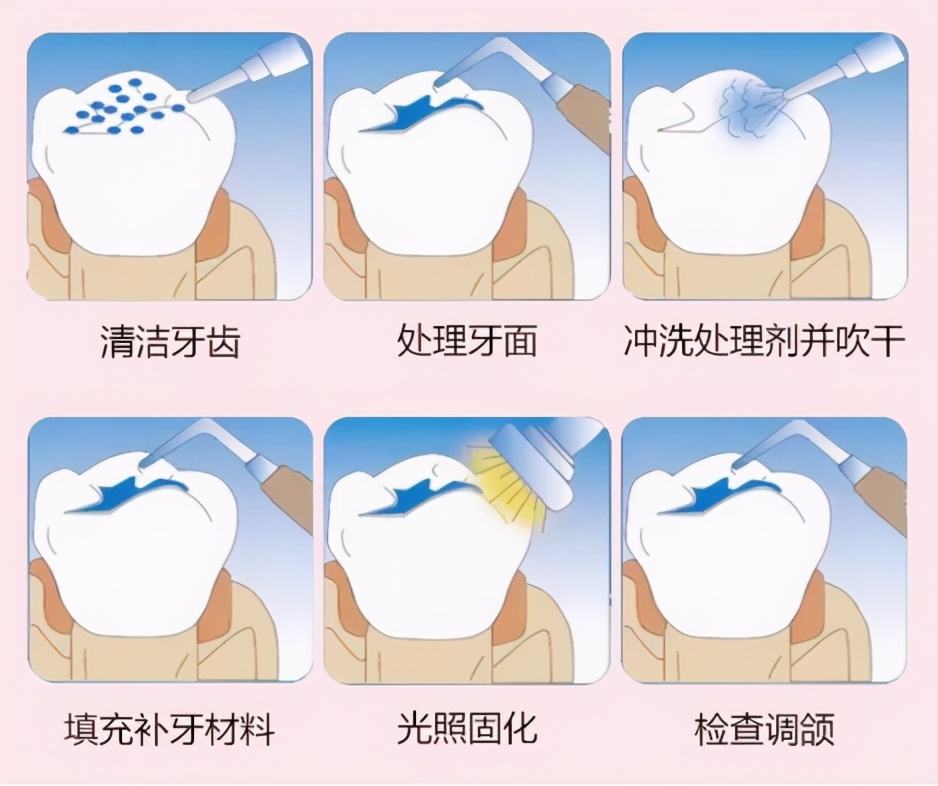 小洞不补大洞吃苦的意思,小洞不补大洞吃苦的道理