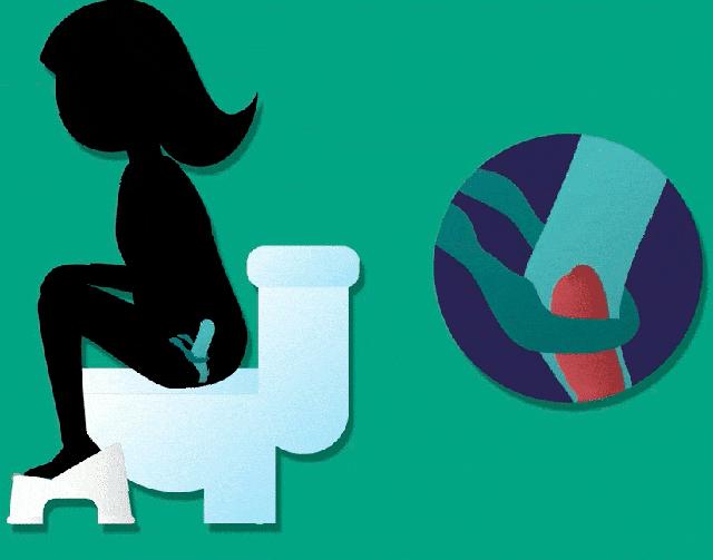 拉屎太用力有什么后果,拉屎便秘快速解决小妙招