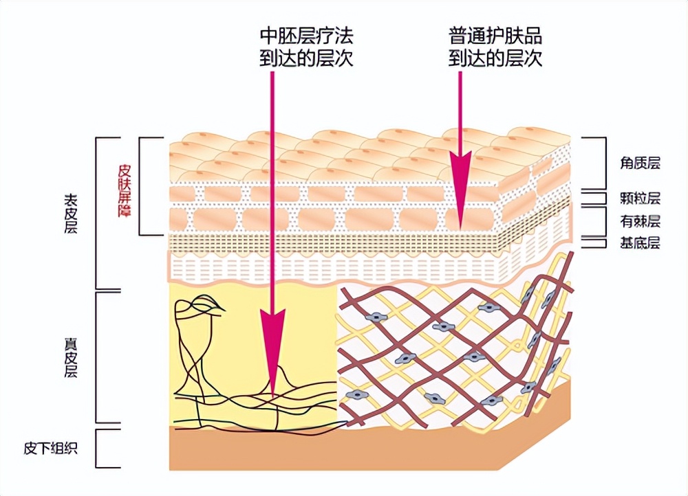 水光针多久可以护肤,水光针多长时间能护肤